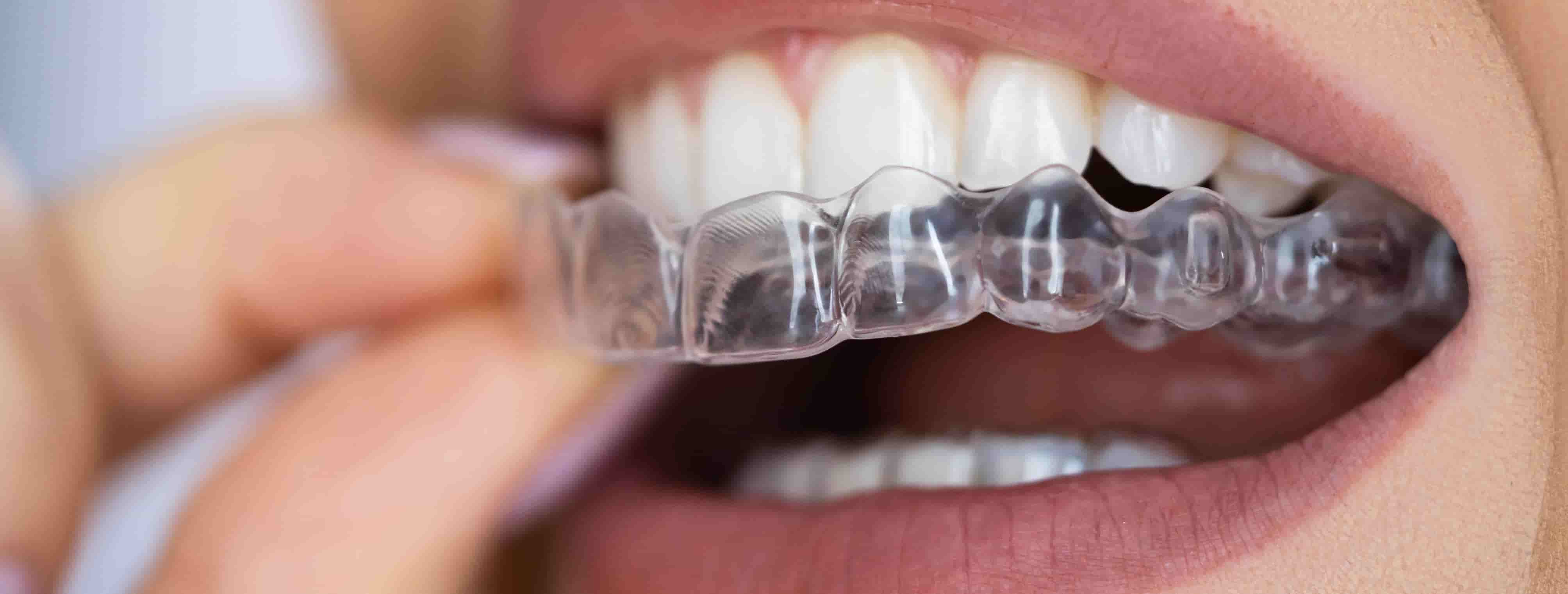 Connecting with a Dentist Near Me: Your Guide to Exceptional Dental Care